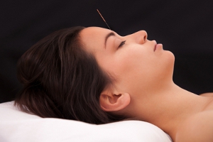 Facial acupuncture